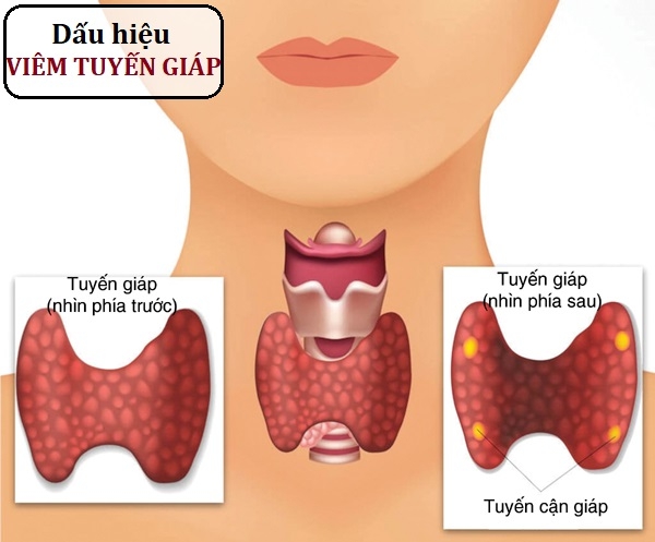 viem-tuyen-giap-2-17095174426851876812576-1723865131652-1723865132186559520325.jpg