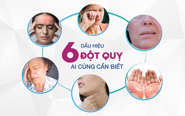 Ngủ dậy thấy dấu hiệu này cần đề phòng đột quỵ - Ảnh 4.