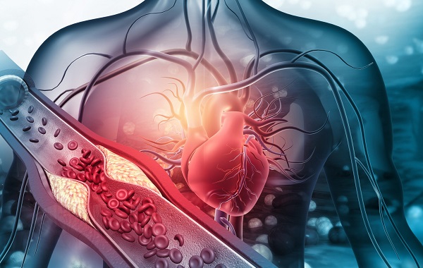 giam-cholesterol-1-1726471639769652808085-1726648293297-17266482939672120149928.jpg