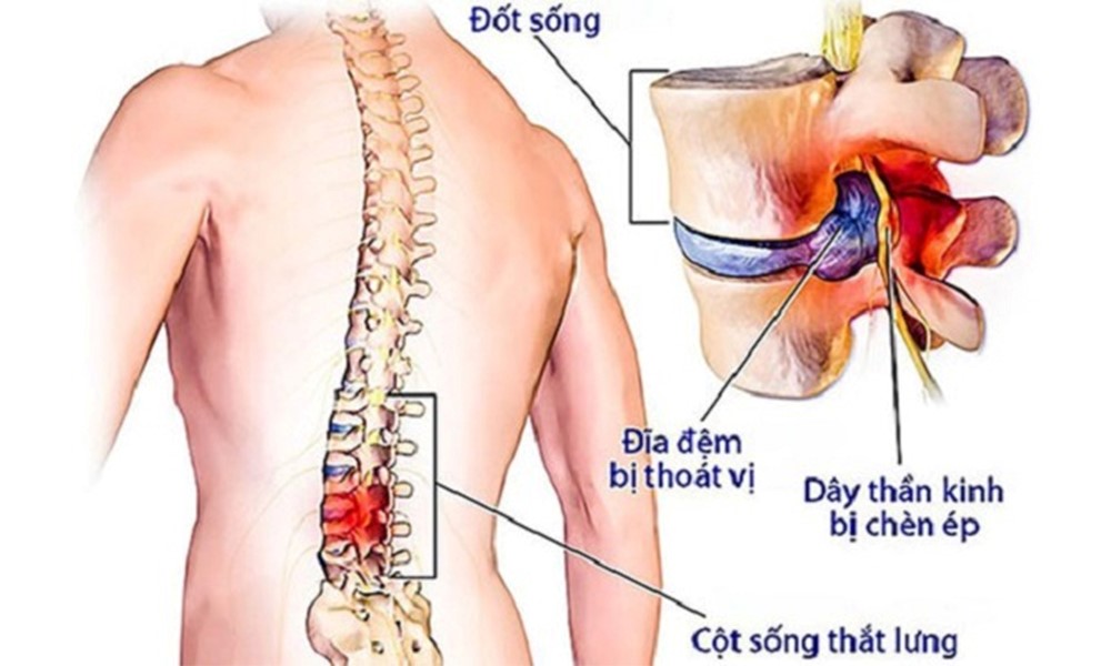 thoat-vi-dia-dem-1727268141173942011998-1727451947116-1727451947685908920639.jpg