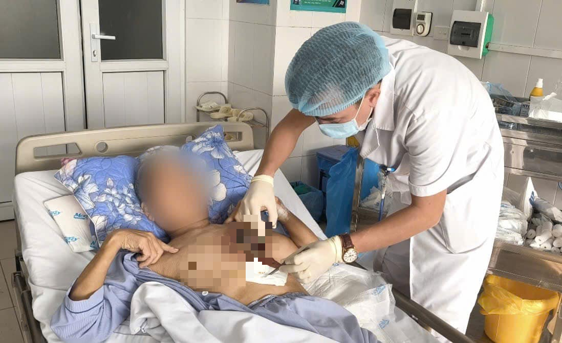 Nhiễm loại nấm hiếm gặp, người quản trang hoại tử vùng ngực  - Ảnh 1.