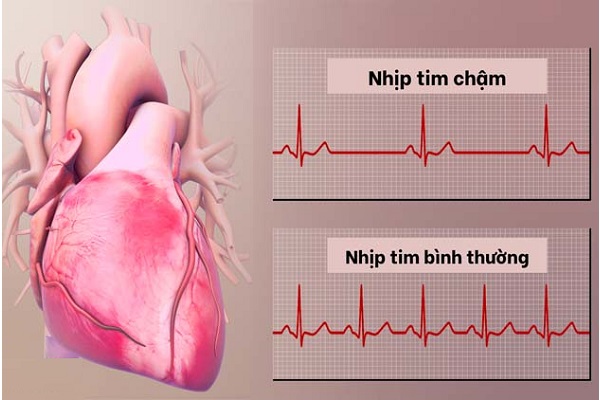 Dấu hiệu tiềm ẩn cảnh báo thiếu iốt, bổ sung bằng cách nào?- Ảnh 1. Dấu hiệu tiềm ẩn cảnh báo thiếu iốt, bổ sung bằng cách nào?- Ảnh 1.