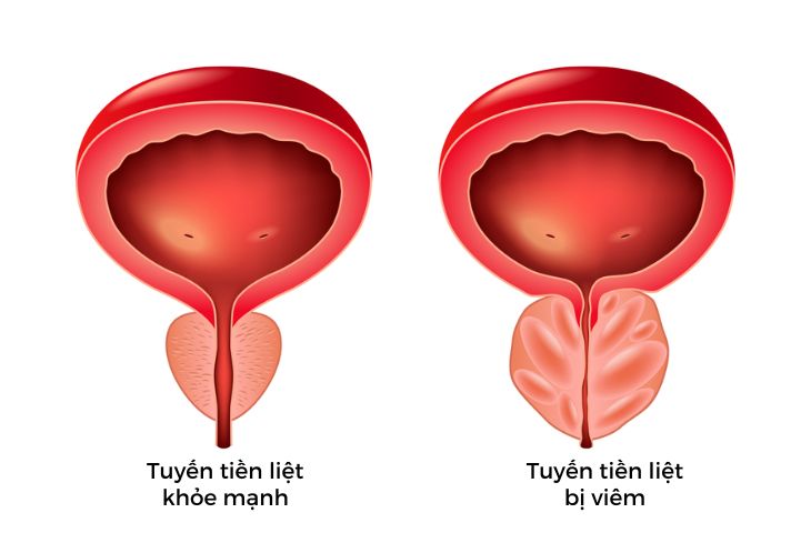 viem-tuyen-tien-liet-17355465116991767108665-1735892473575-1735892473780163585342.jpg