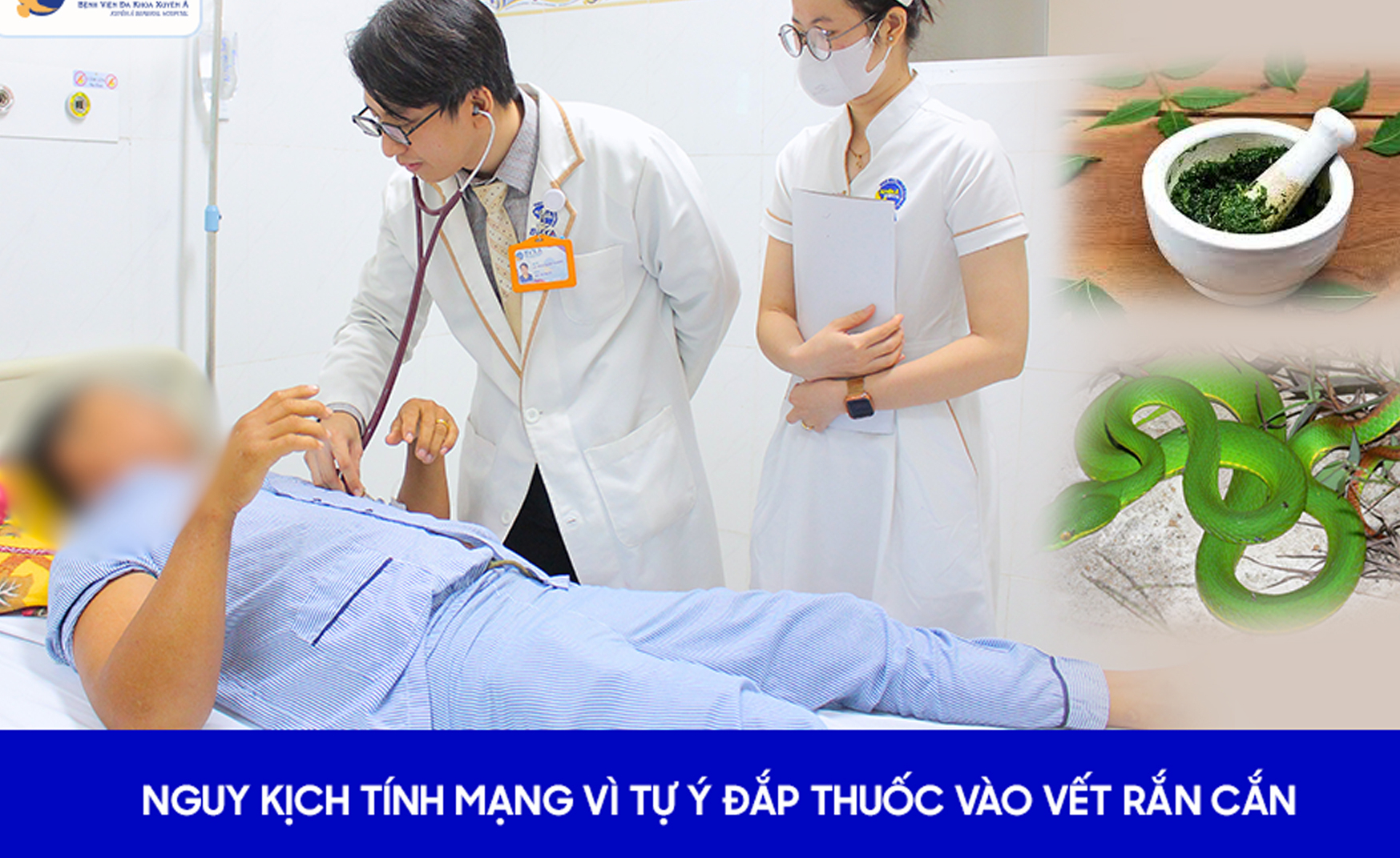 Người đàn ông 51 tuổi ở Long An nguy kịch vì tự ý làm việc này sau khi bị rắn cắn - Ảnh 2.