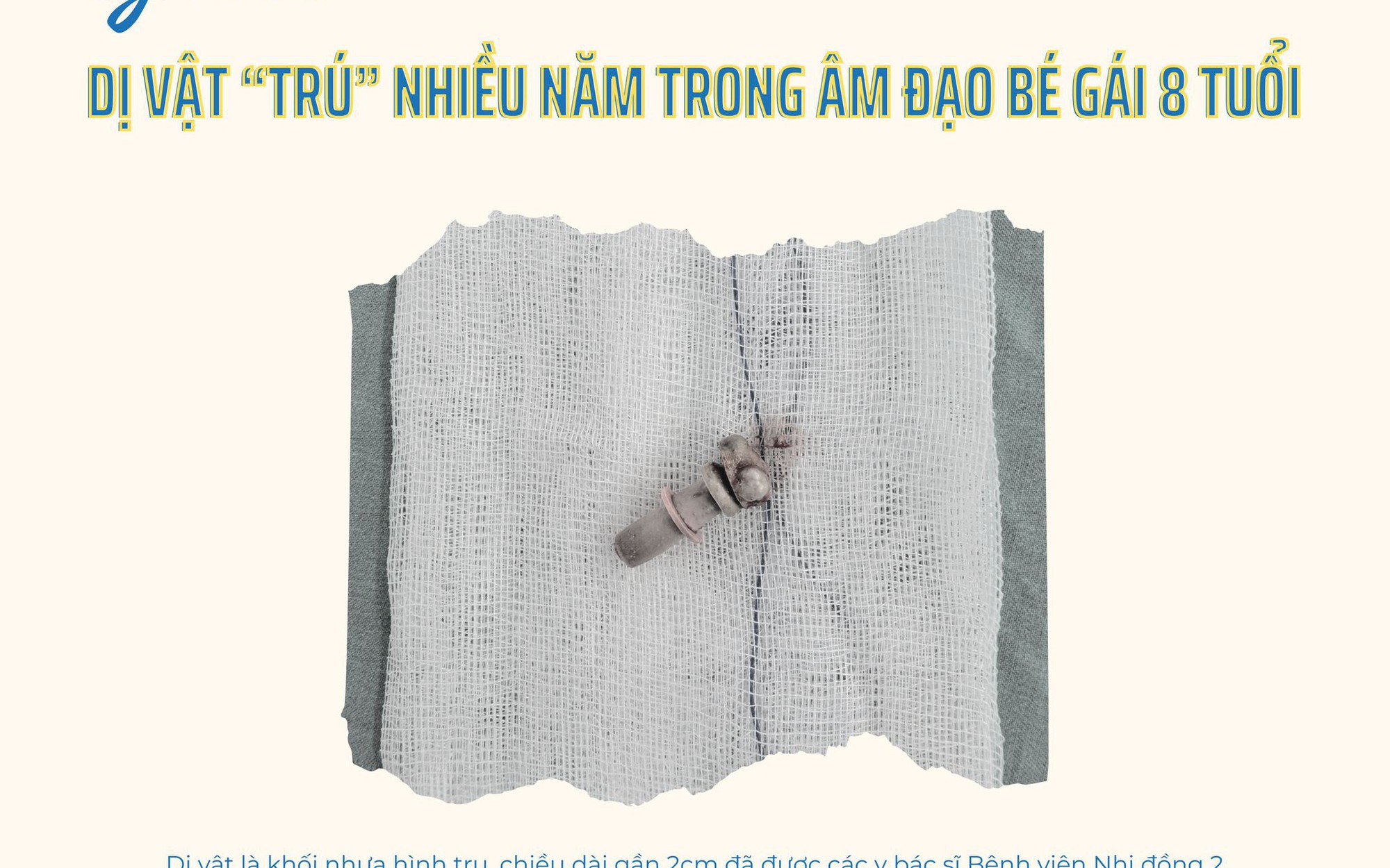 Bất ngờ phát hiện dị vật trú nhiều năm trong vùng kín bé gái 9 tuổi