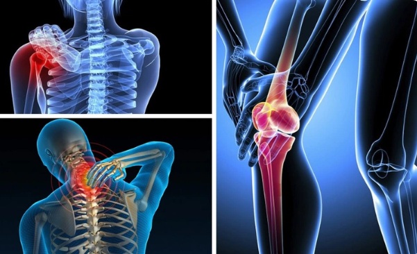 Người bệnh đau xương khớp dễ bị tái phát trong những ngày mưa bão: 4 cách phòng tránh an toàn, hiệu quả - Ảnh 1.