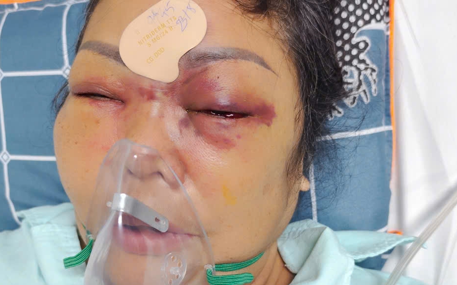 Xe ô tô gặp nạn tại công trình 370 tỷ ở Hà Nội , người dân lo lắng về an toàn - Ảnh 9.