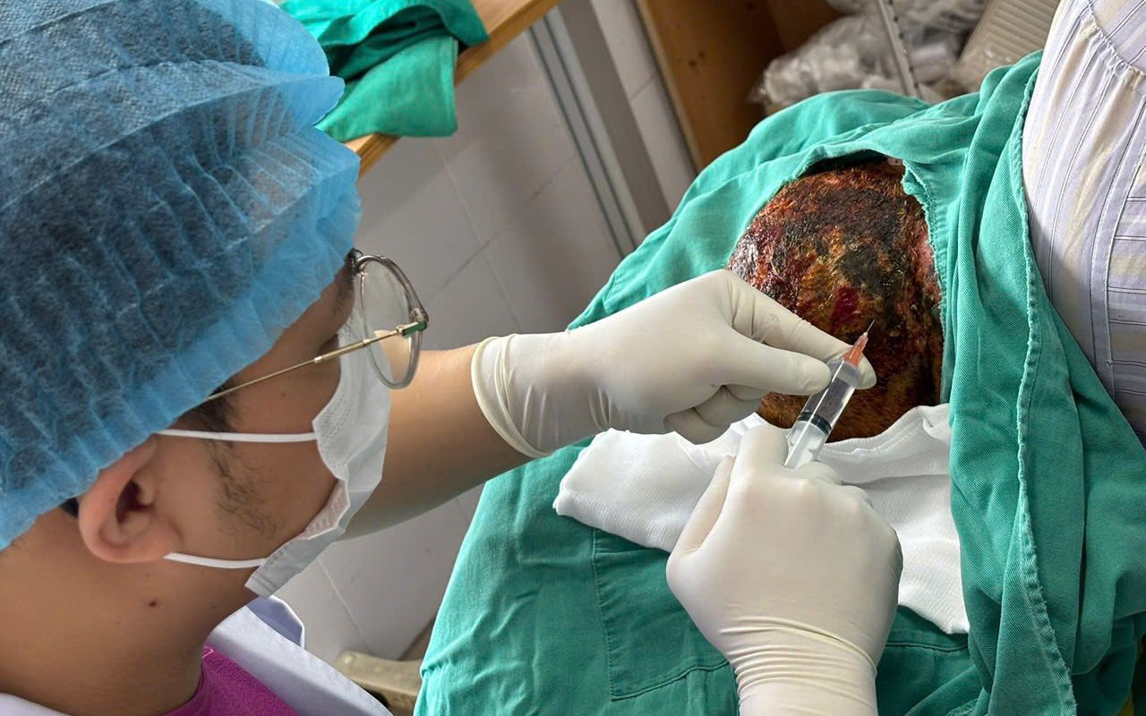 Đau đầu, nổi b&oacute;ng nước tưởng c&ocirc;n tr&ugrave;ng cắn, người đ&agrave;n &ocirc;ng su&yacute;t m&ugrave; mắt v&igrave; zona thần kinh - Ảnh 3.