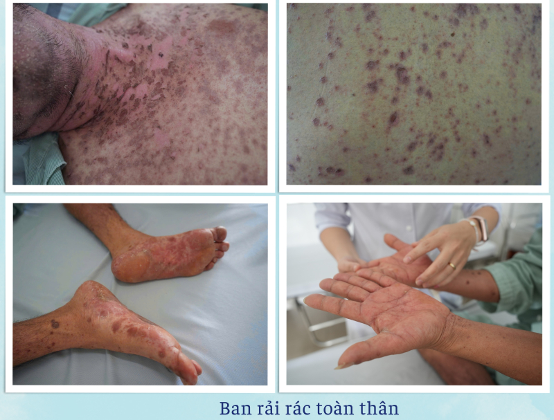 ban-di-ung-1760433611566-17604336122632018538321.jpg