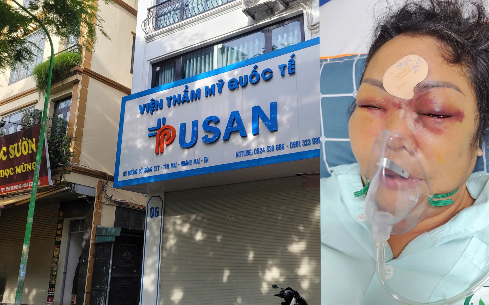 Xe ô tô gặp nạn tại công trình 370 tỷ ở Hà Nội , người dân lo lắng về an toàn - Ảnh 10.