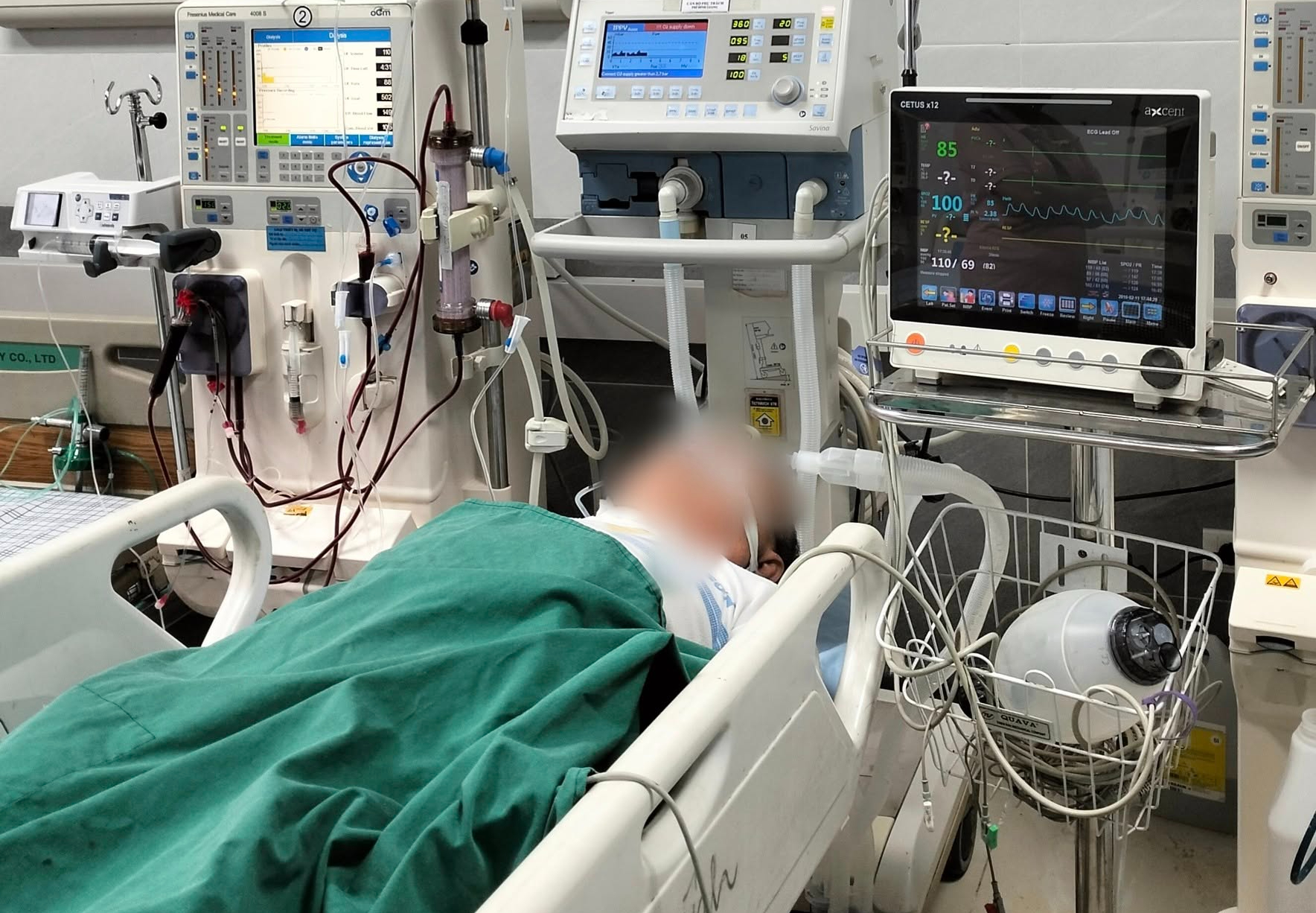 Người đàn ông ở Phú Thọ hôn mê sâu, suy hô hấp thừa nhận một sai lầm nhiều nam giới VIệt mắc phải - Ảnh 1.