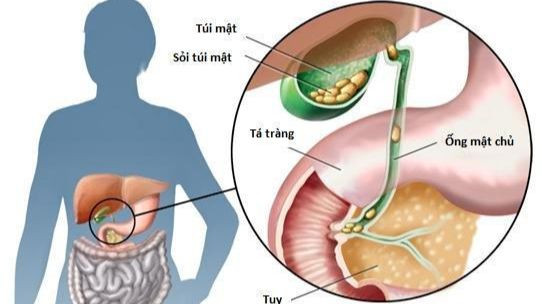 soi-tui-mat-5-1761648757750621619381.jpg
