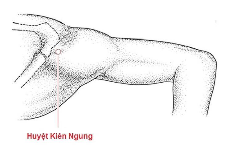huyet-kien-ngung-2-1759710910977180841578-1759764624671-1759764624917171618855.jpg