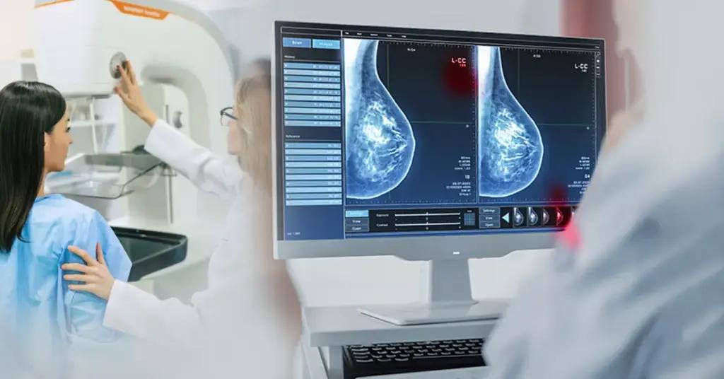 Phát hiện sớm ung thư vú nhờ ứng dụng AI trong chụp nhũ ảnh tầm soát- Ảnh 1. Phát hiện sớm ung thư vú nhờ ứng dụng AI trong chụp nhũ ảnh tầm soát- Ảnh 1.