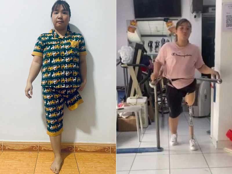 Tai nạn kinh hoàng cướp đi mẹ ruột và 1 chân, cô gái được mẹ chồng bù đắp tất cả - Ảnh 1.