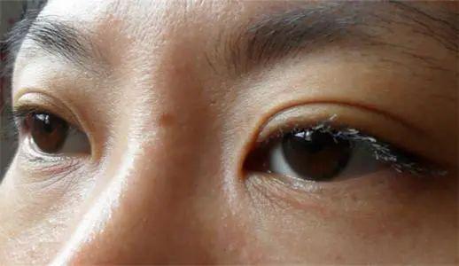 Chỉ cần nhìn vào mặt có thể biết thận của bạn khỏe đến mức nào: Phương pháp cực đơn giản để nuôi dưỡng và tăng cường thận hiệu quả - Ảnh 1.