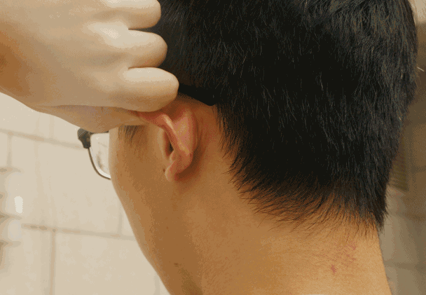 Chỉ cần nhìn vào mặt có thể biết thận của bạn khỏe đến mức nào: Phương pháp cực đơn giản để nuôi dưỡng và tăng cường thận hiệu quả - Ảnh 3.