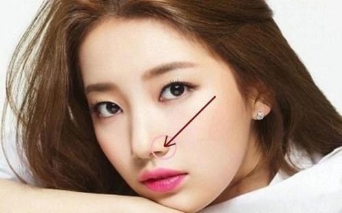 4 vị trí nốt ruồi dễ khiến tài vận biến động, tiền bạc khó tụ - Ảnh 1.