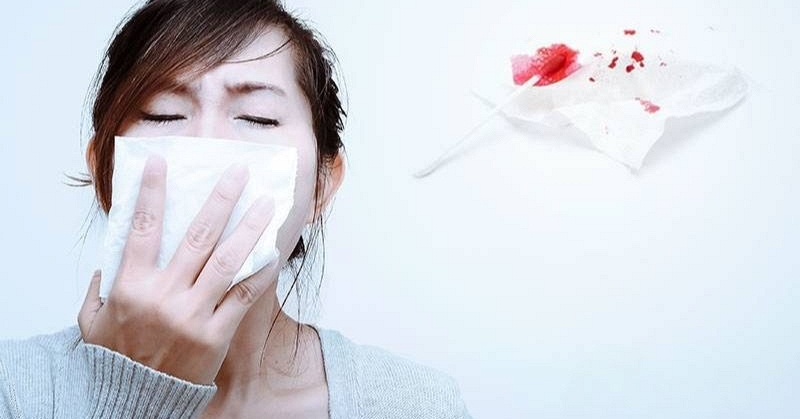 Khô mũi, chảy máu mũi trong ngày hanh khô: Cách chăm sóc và ngăn ngừa hiệu quả - Ảnh 4.