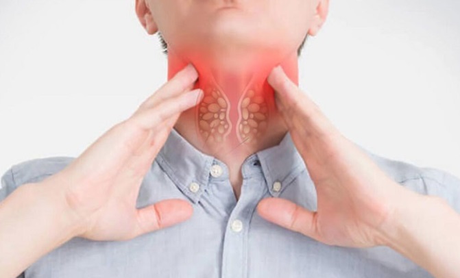Người đàn ông 31 tuổi ở Bắc Ninh phát hiện ung thư tuyến giáp thừa nhận 1 sai lầm nhiều người Việt mắc phải - Ảnh 3.
