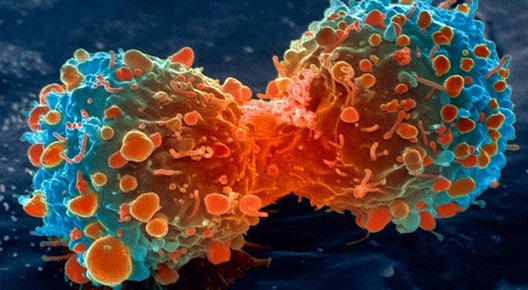 3 nguyên tắc ngăn chặn tế bào ung thư, người Việt nên làm ngay để nói không với bệnh - Ảnh 3. 3 nguyên tắc ngăn chặn tế bào ung thư, người Việt nên làm ngay để nói không với bệnh - Ảnh 3.