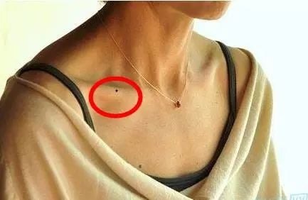 Sở hữu nốt ruồi ở những vị trí này, cuộc sống viên mãn, tình tiền hanh thông - Ảnh 1. Sở hữu nốt ruồi ở những vị trí này, cuộc sống viên mãn, tình tiền hanh thông - Ảnh 1.