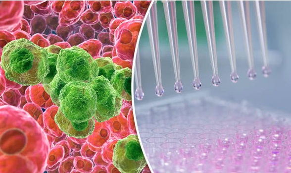 Tế bào ung thư sợ gì nhất? Giải pháp tăng cường hệ miễn dịch ngăn ngừa tế bào ung thư? - Ảnh 1. Tế bào ung thư sợ gì nhất? Giải pháp tăng cường hệ miễn dịch ngăn ngừa tế bào ung thư? - Ảnh 1.