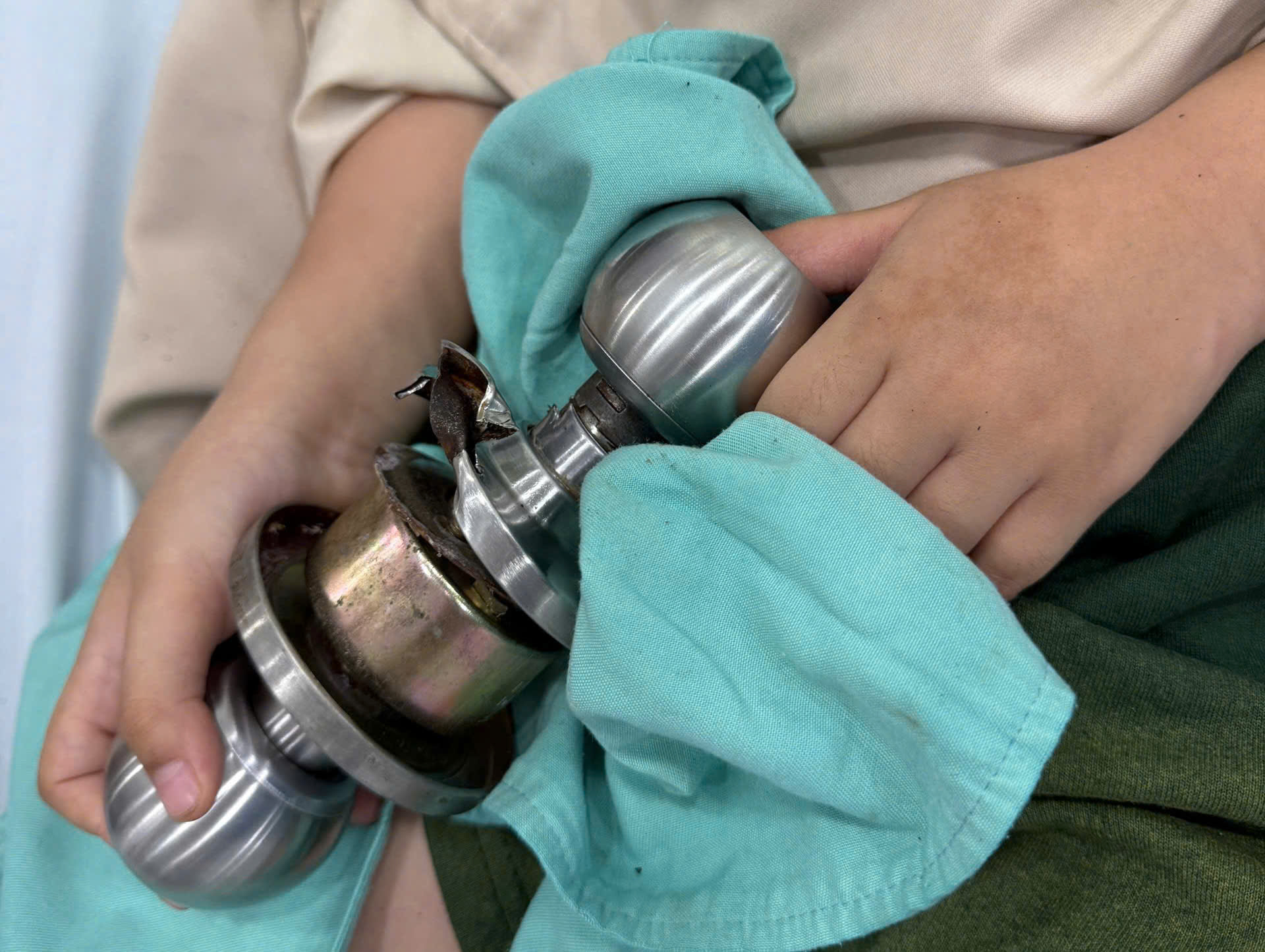 Nghịch dại, bé 5 tuổi ‘ôm’ ổ khóa nhập viện cấp cứu - Ảnh 1.