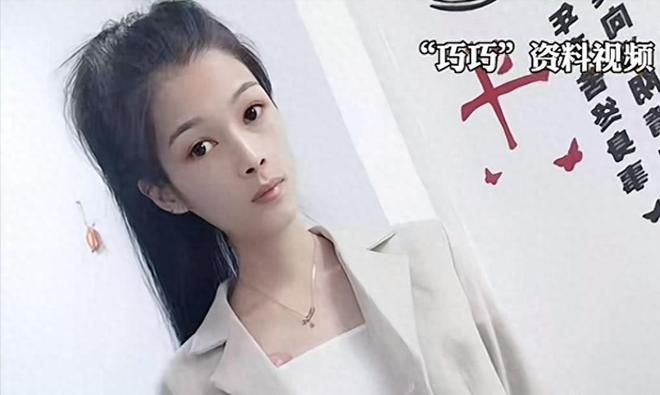 Bệnh g&igrave; khiến người phụ nữ 27 tuổi cao 1,6m nhưng chỉ nặng 17,5kg bị "teo dạ d&agrave;y" v&agrave; qua đời: BS khuyến c&aacute;o loại vi khuẩn c&oacute; li&ecirc;n quan - Ảnh 1.