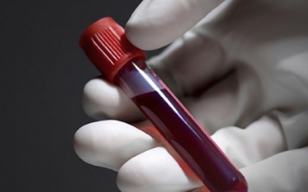 Con g&aacute;i ng&agrave;y c&agrave;ng giống người y&ecirc;u cũ của vợ, t&ocirc;i muốn x&eacute;t nghiệm ADN