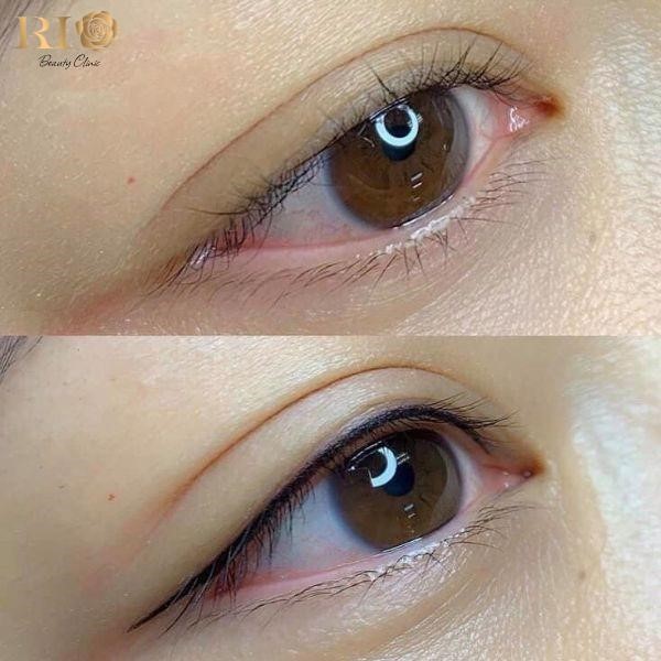 Phun mí Glamor tạo điểm nhấn cho đôi mắt tại Thẩm Mỹ Rio - Ảnh 1.