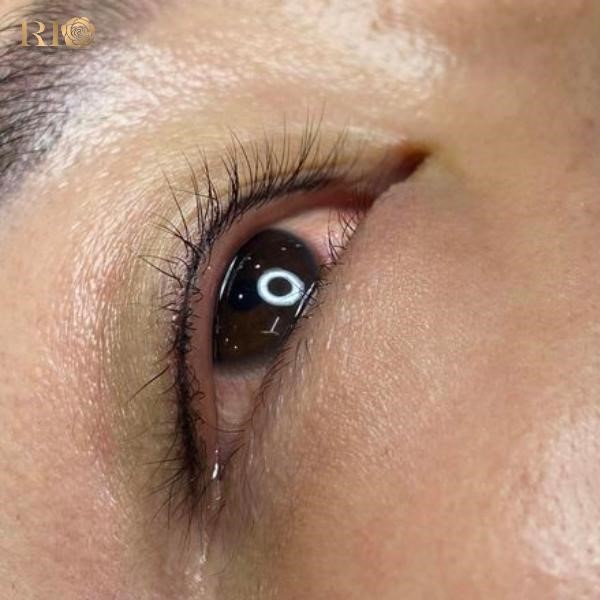 Phun mí Glamor tạo điểm nhấn cho đôi mắt tại Thẩm Mỹ Rio - Ảnh 2.