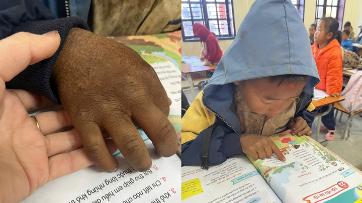 Hình ảnh bàn tay nứt nẻ của cậu bé 8 tuổi vùng cao khiến triệu người nghẹn lại - Ảnh 1.