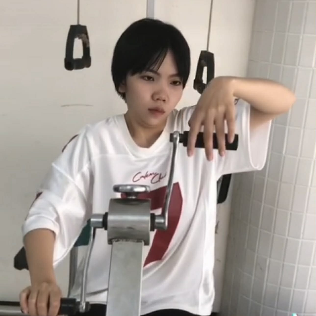 Chiếc máy sấy rơi khỏi tay, cơn đột quỵ ập tới với cô gái 21 tuổi - Ảnh 2.