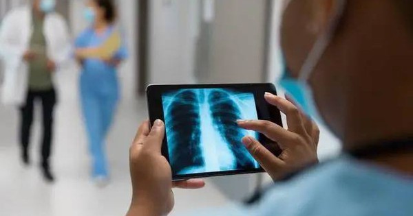 Người đàn ông 49 tuổi bị tràn khí màng phổi thừa nhận một sai lầm suốt 30 năm nhiều người Việt mắc phải - Ảnh 3.