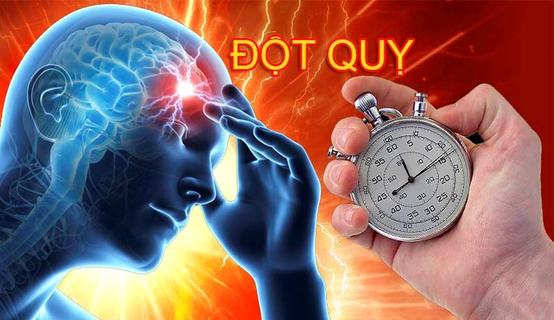 Nhồi máu não rất dễ xảy ra trong thời gian này! 8 điều cần làm vào mùa đông để giảm nguy cơ  - Ảnh 1.