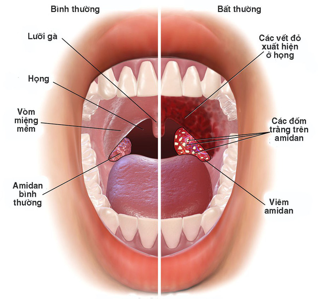 viem-hong-khi-troi-lanh-1739182876071478384630.jpg