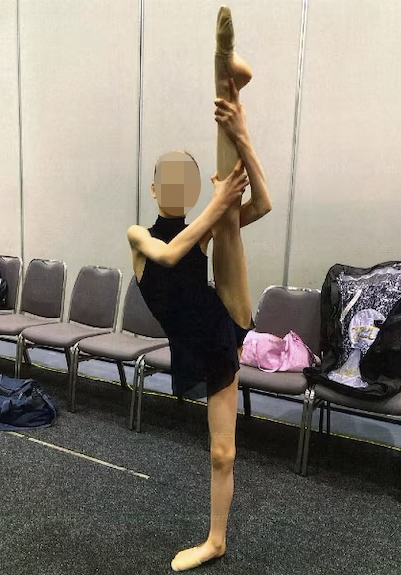 unnamed-ballerina-victim-malnourishment-parents-98662192-17397844861261380814071-1739838236087-17398382361791404960678.jpg