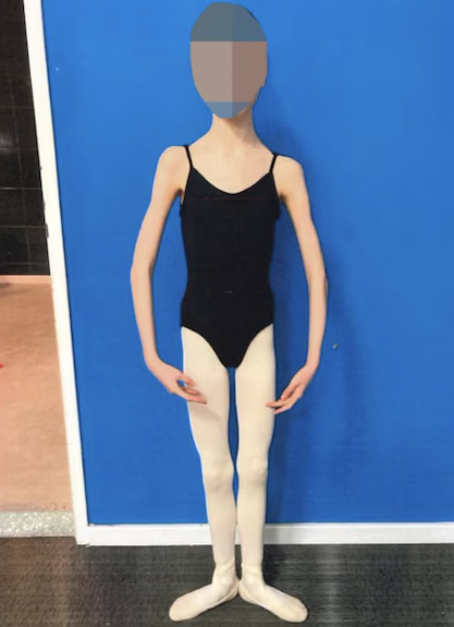 unnamed-ballerina-victim-malnourishment-parents-98662196-1739784451587467693322-1739838235047-1739838235171414868901.jpg