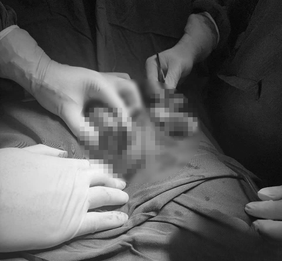 Đang đá bóng, nam sinh ở Hà Nội nhập viện gấp vì tai nạn ở vùng kín- Ảnh 1.