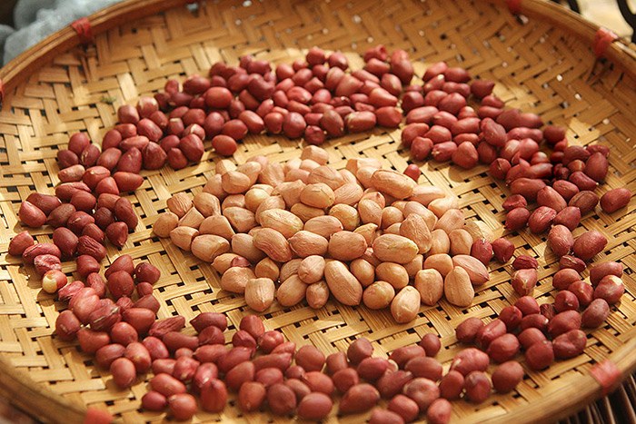 Người phụ nữ nhập viện vì men gan cao gấp 10 lần thừa nhận một sai lầm khi ăn nhiều người Việt mắc phải- Ảnh 4.