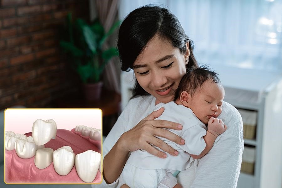 Đang cho con bú có bọc răng sứ được không?- Ảnh 1.