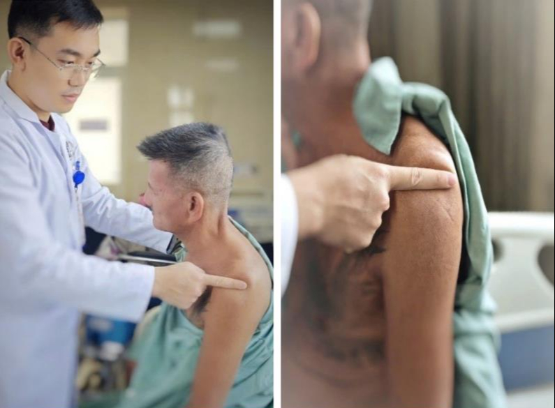 Người đàn ông 60 tuổi bị di chứng đột quỵ, thoát đau nhờ 3 tháng kiêng trì làm việc này - Ảnh 2.