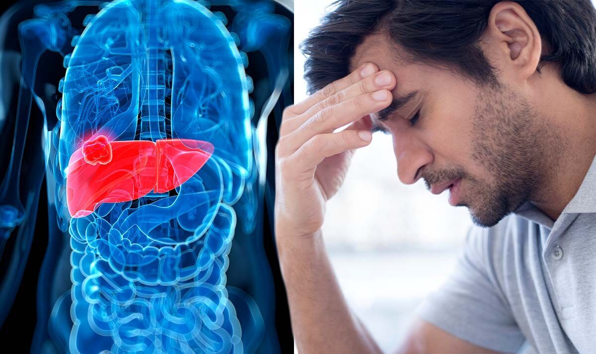 Men gan thấp nguy hiểm không? Người có dấu hiệu này cần cảnh giác- Ảnh 4.