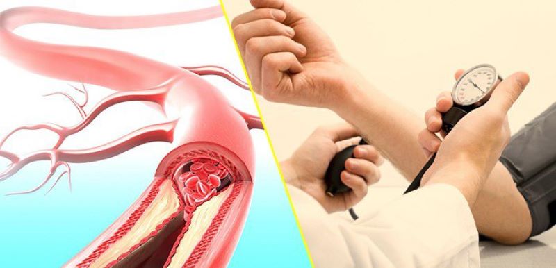 Người phụ nữ 65 tuổi ở Hà Nội bị đột quỵ thừa nhận một sai lầm mà rất nhiều người Việt mắc phải- Ảnh 3.