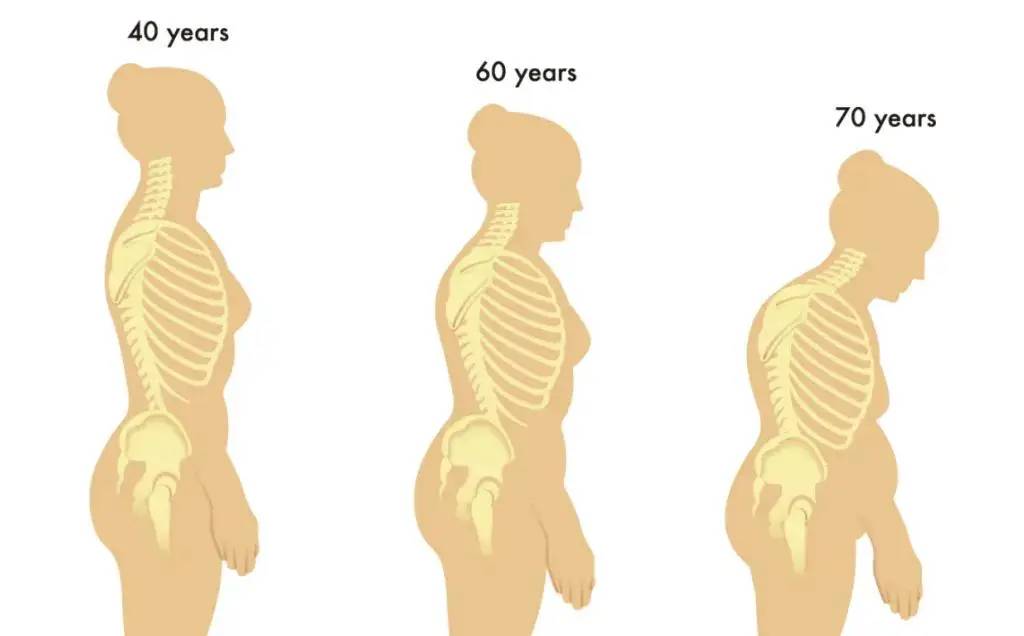 40 tuổi nhưng sáng nào ngủ dậy cũng đau lưng, tôi giật mình khi bác sĩ nói 40 tuổi nhưng sáng nào ngủ dậy cũng đau lưng, tôi giật mình khi bác sĩ nói