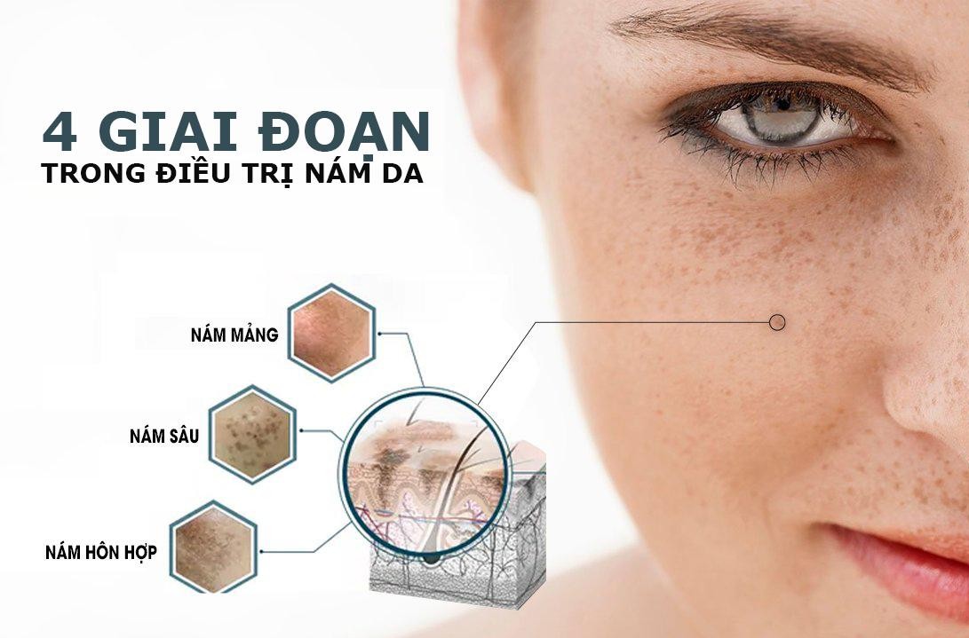 dieu-tri-nam-trung-binh-17452908955621622582519-1746083647961-17460836483711587557291.jpg