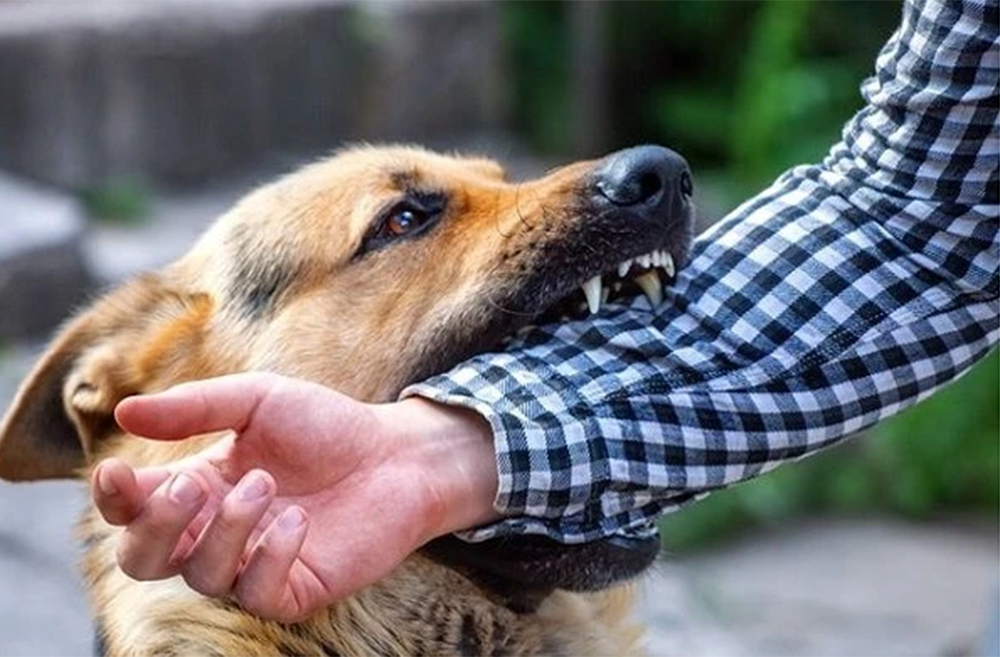 Bé trai 13 tuổi nguy kịch sau 2 tháng bị chó cắn vì việc làm này của người thân - Ảnh 1.