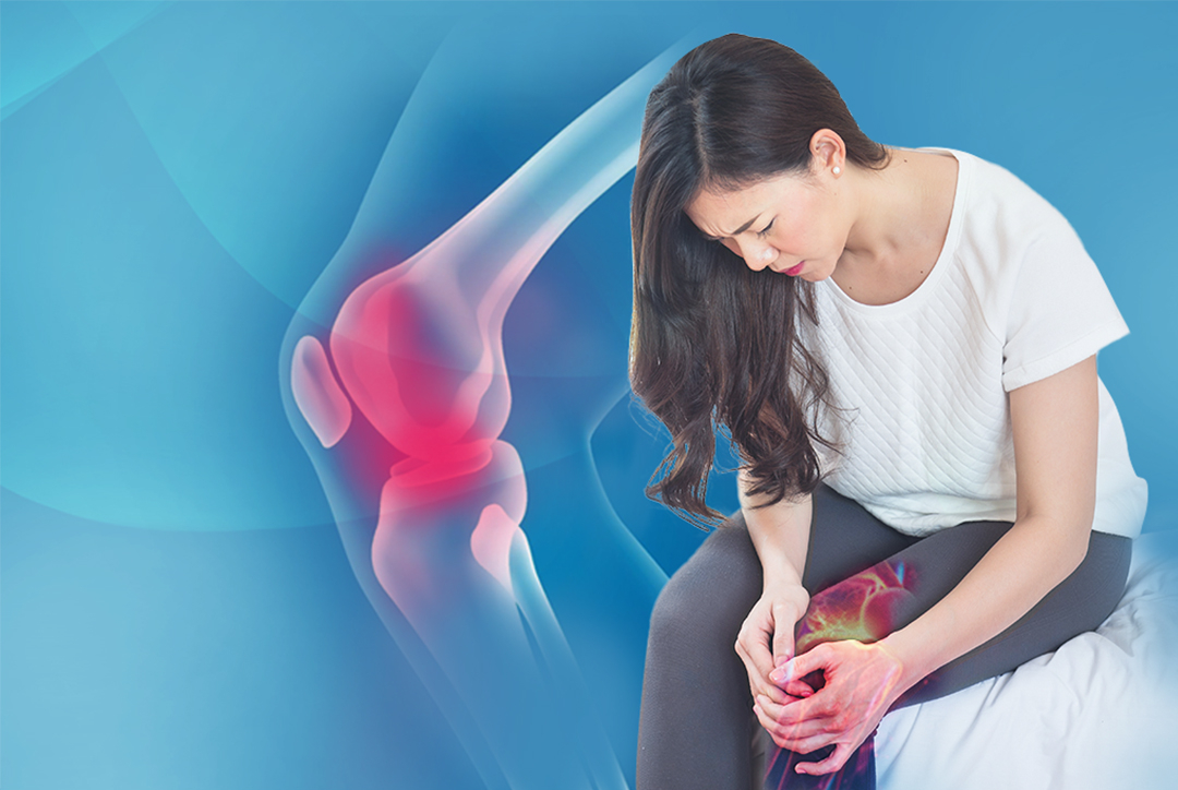 Bất ngờ 7 nguyên nhân gây thoái hóa khớp gối, phụ nữ U50 cần cảnh giác - Ảnh 2.