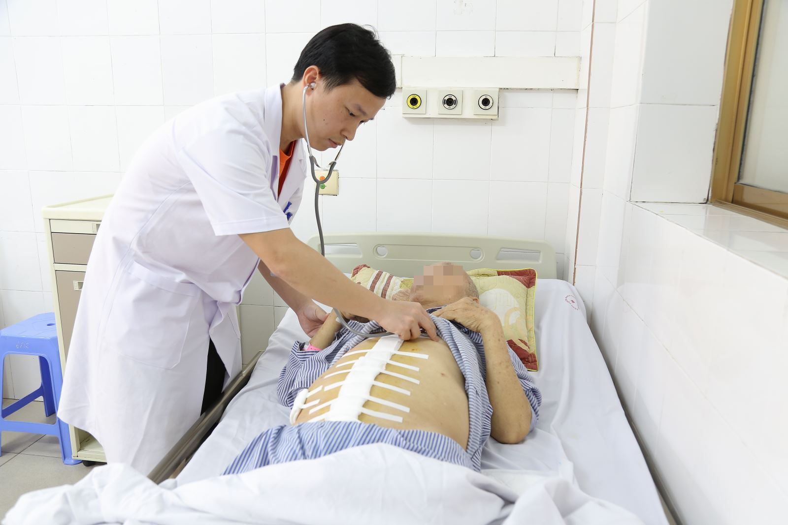Người đàn ông ở Quảng Ninh bị vỡ phình động mạch chủ bụng từ dấu hiệu nhiều người Việt bỏ qua - Ảnh 3.